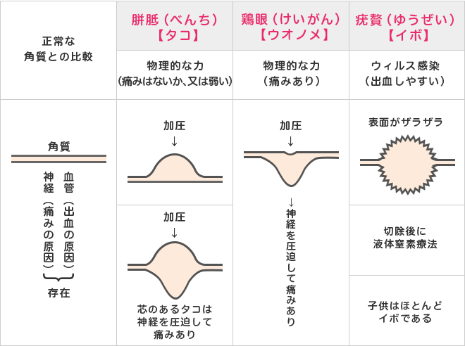 正常な角質との比較